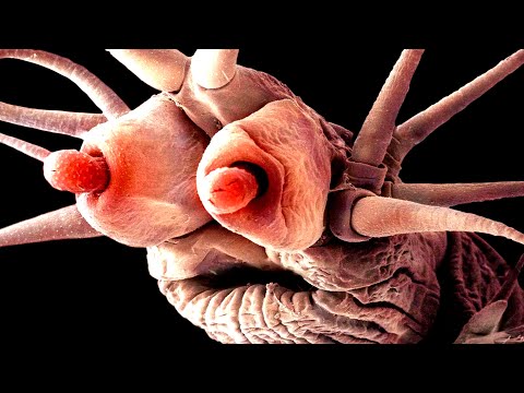 Objects Under Electron Microscope (Part 3)